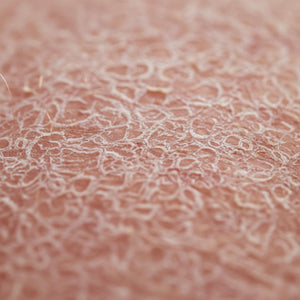 Dry, red, itch skin